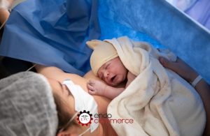 Como é Feita a Cesárea Um Guia Passo a Passo, do Pré ao Pós-Parto
